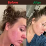 Puritan's Pride Zinc for Acne (100 Tablets) - Image 4